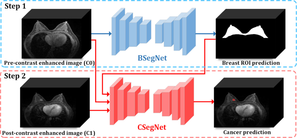 ESWA | Joint-phase attention network for breast cancer segmentation in DCE-MRI