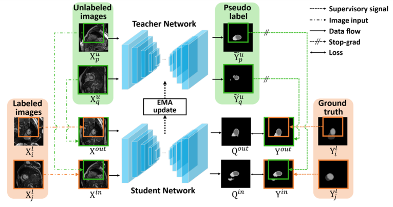 CVPR2023 | Bidirectional Copy-Paste for Semi-Supervised Medical Image Segmentation