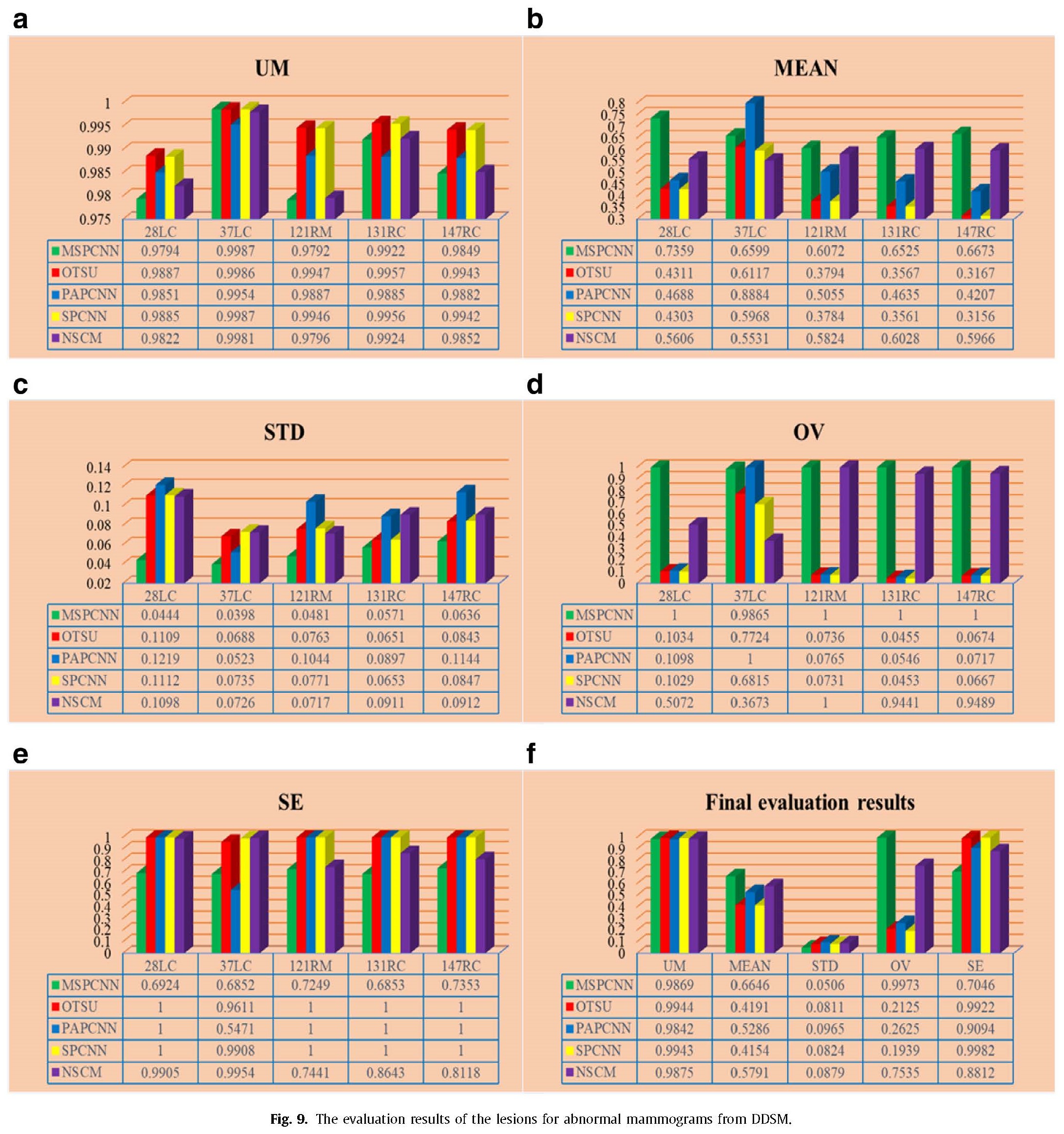 The evaluation results of the lesions for abnormal mammograms from DDSM-wndegfvx.jpg